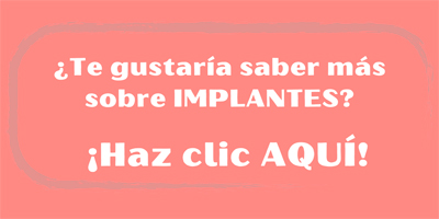 implantes dentales